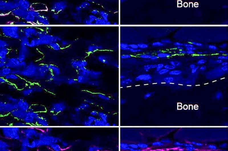 Serendipity opens new path toward osteoporosis treatment
